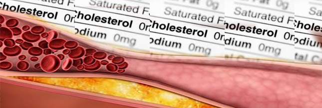 Où en êtes-vous avec votre cholestérol ?