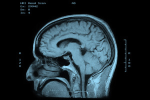 cerveau-brain